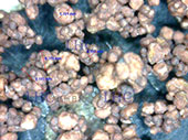 维生素B12尾液